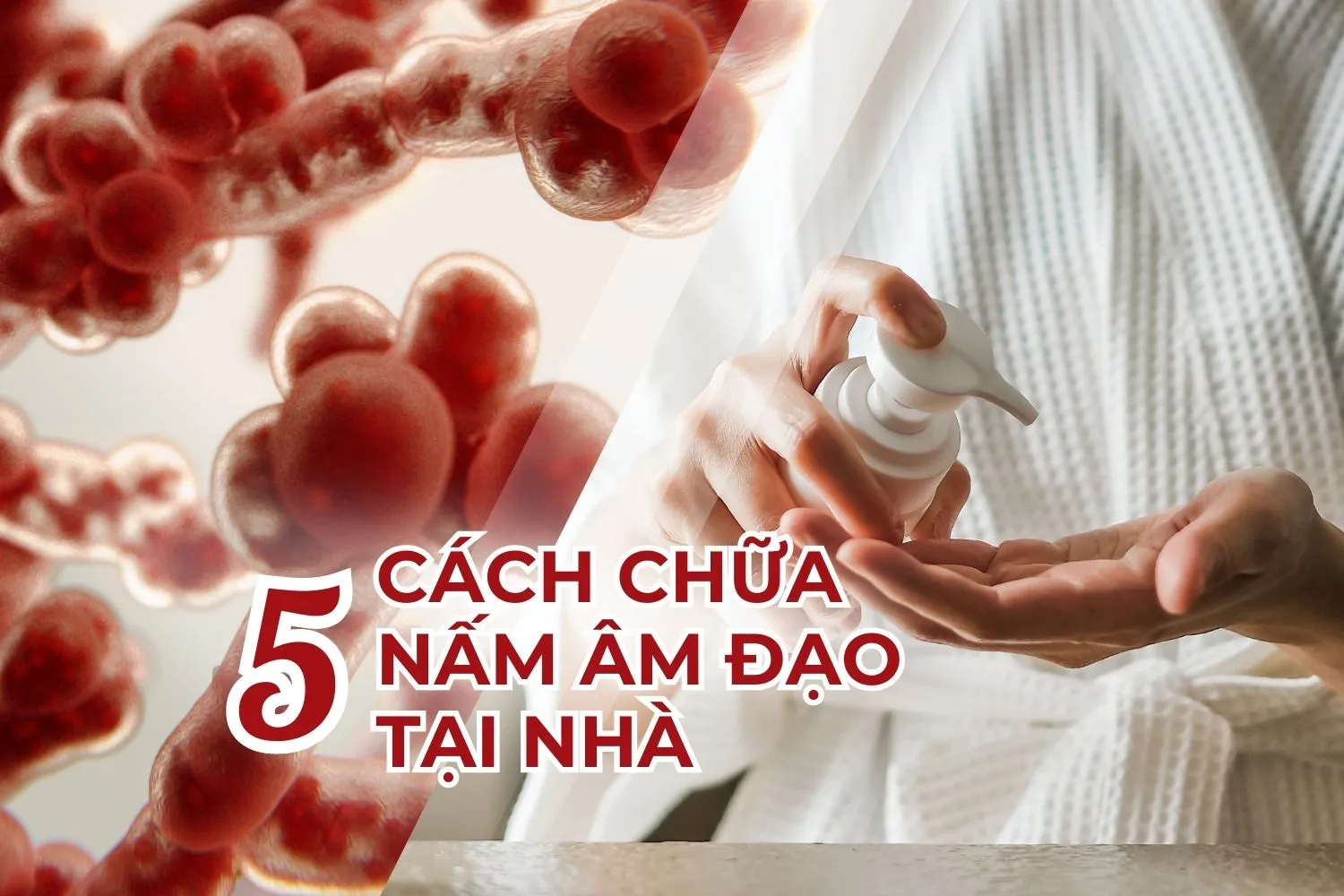 Cách chữa nấm âm đạo tại nhà: Hiệu quả, an toàn và dễ thực hiện