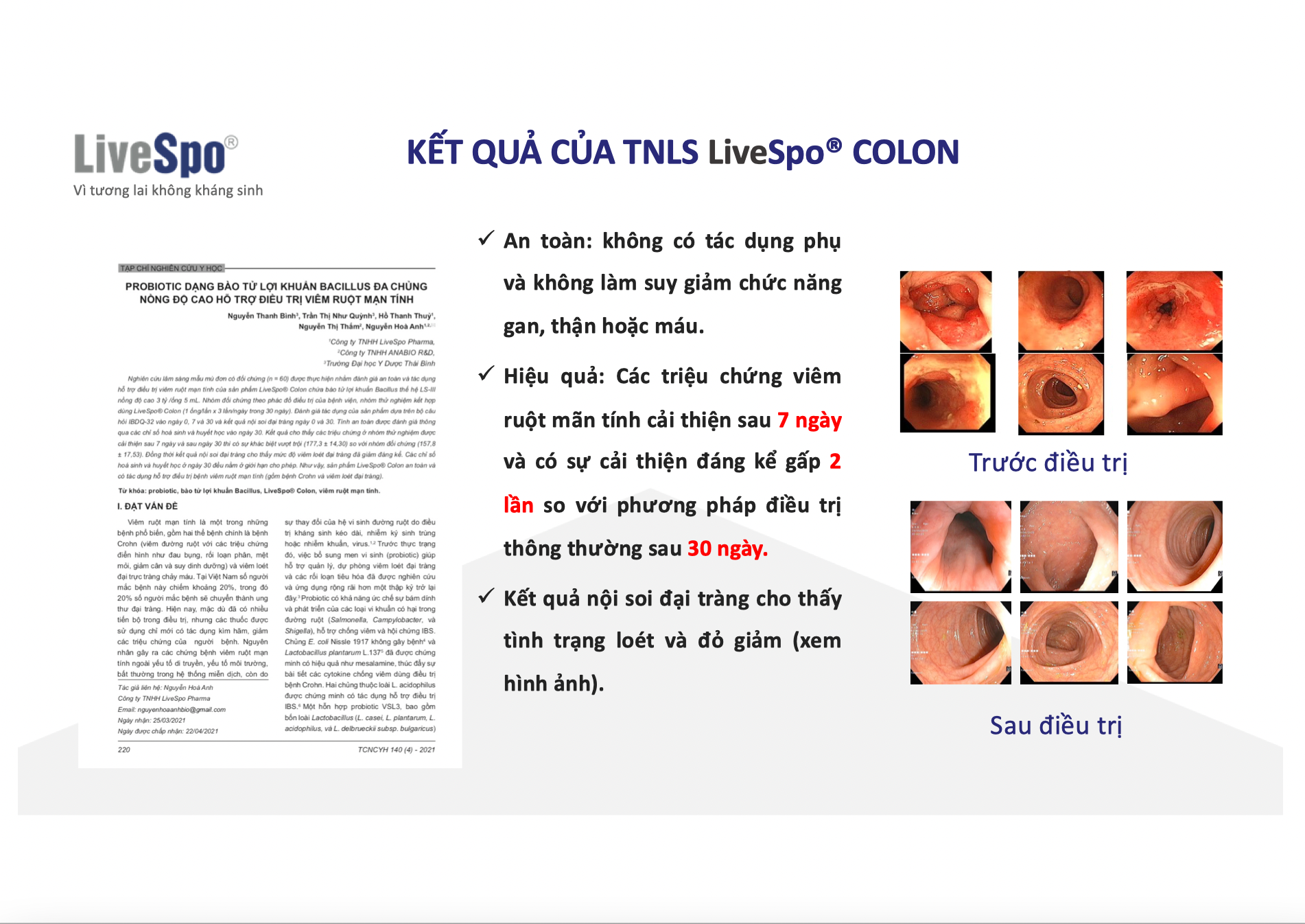 Colon H/10 ống LIVESPO Lợi khuẩn hỗ trợ giảm triệu chứng viêm đại tràng